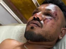 Único sobreviviente del vuelo AI-171 camina entre escombros